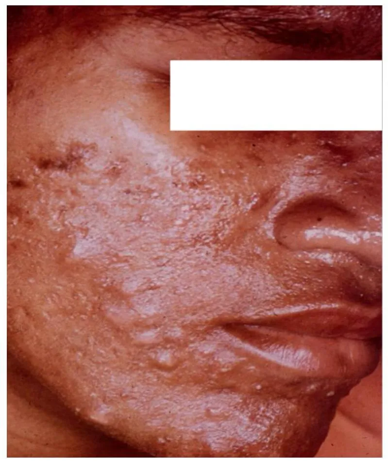 Derma-OSBE-2cdf87f05e1a1761.webp|115x136