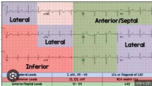 ECG Localization Chart