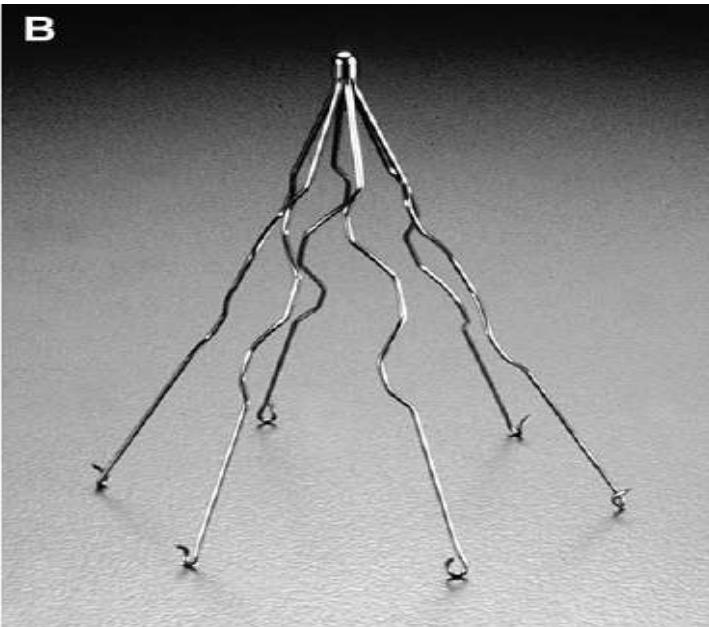 IVC Filter Alternative