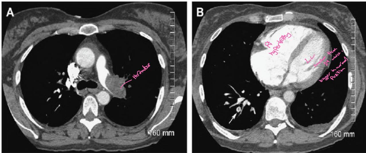 CT Scan Examples