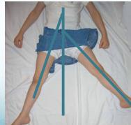 Simultaneous abduction/adduction in extension