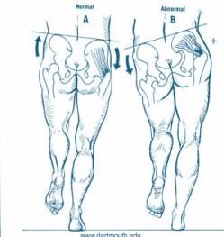 Trendelenburg Test execution