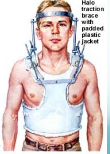 Unstable treatment details