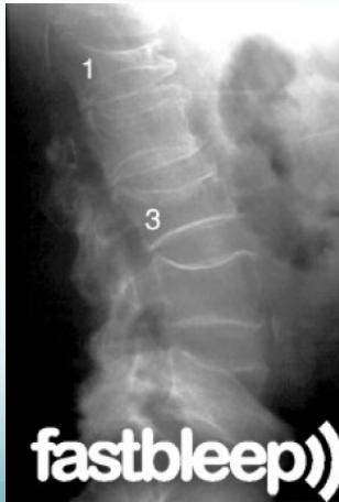 Lumbar compression details