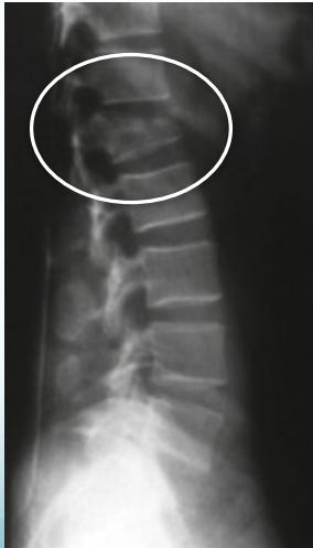 Burst classification