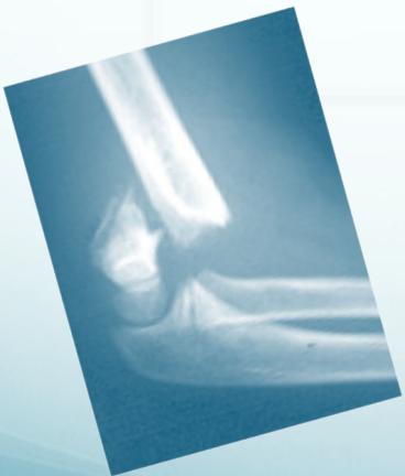 _page_0_Picture_4.jpeg|302x355