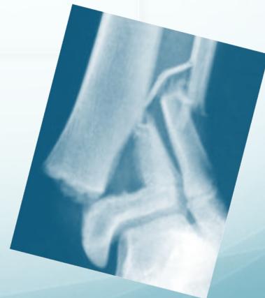 _page_0_Picture_5.jpeg|290x327