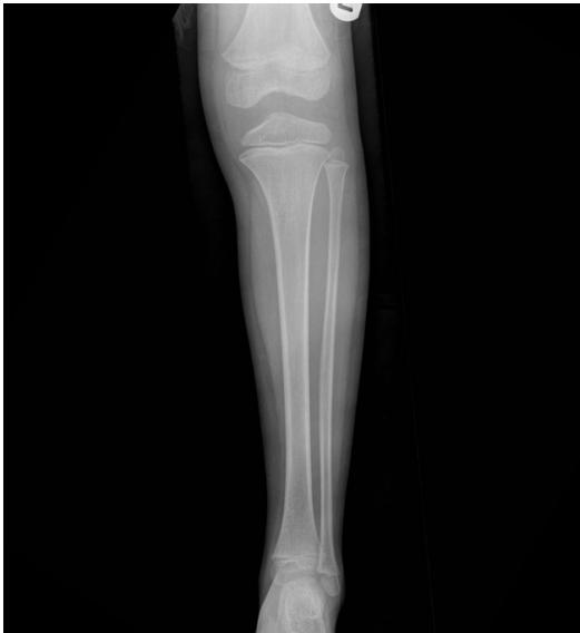 _page_2_Picture_1.jpeg|316x344