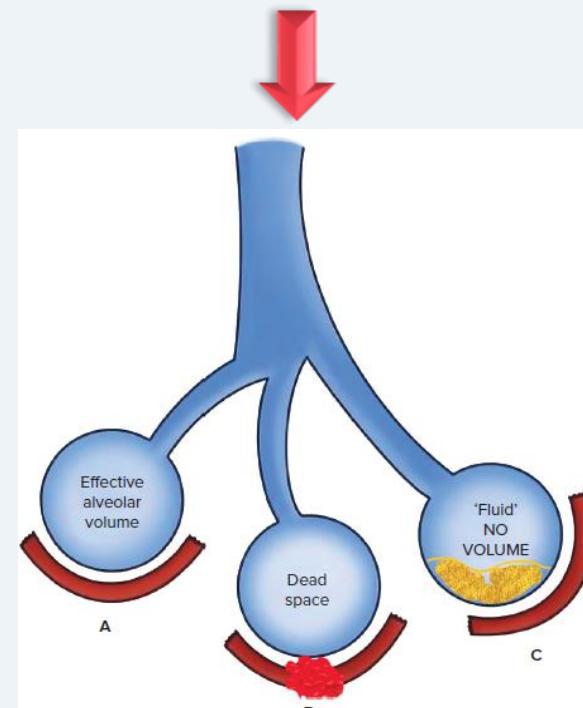 Alveolar gas exchange — illustration 2