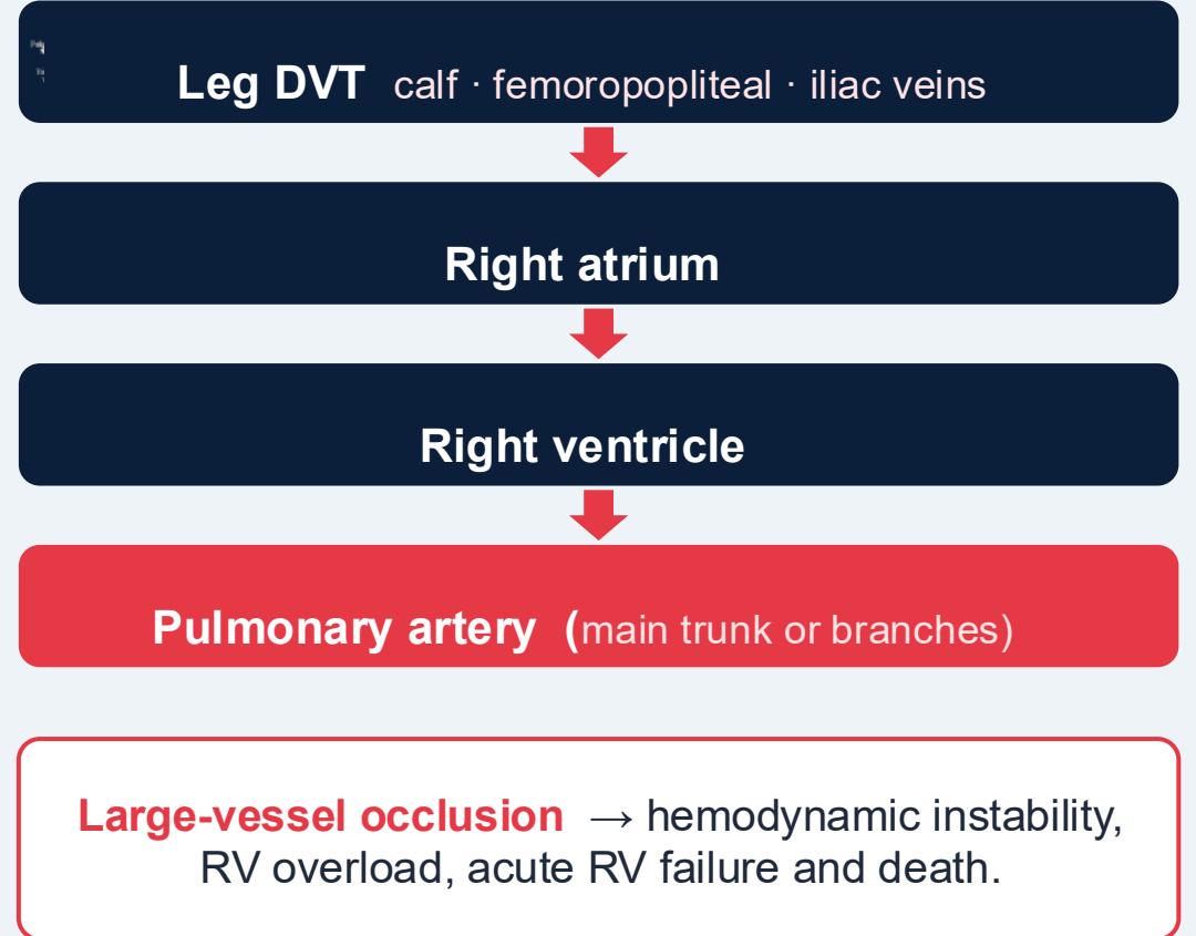 DVT-to-PE embolic route — panel 1
