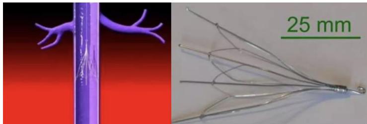 Inferior vena cava filter