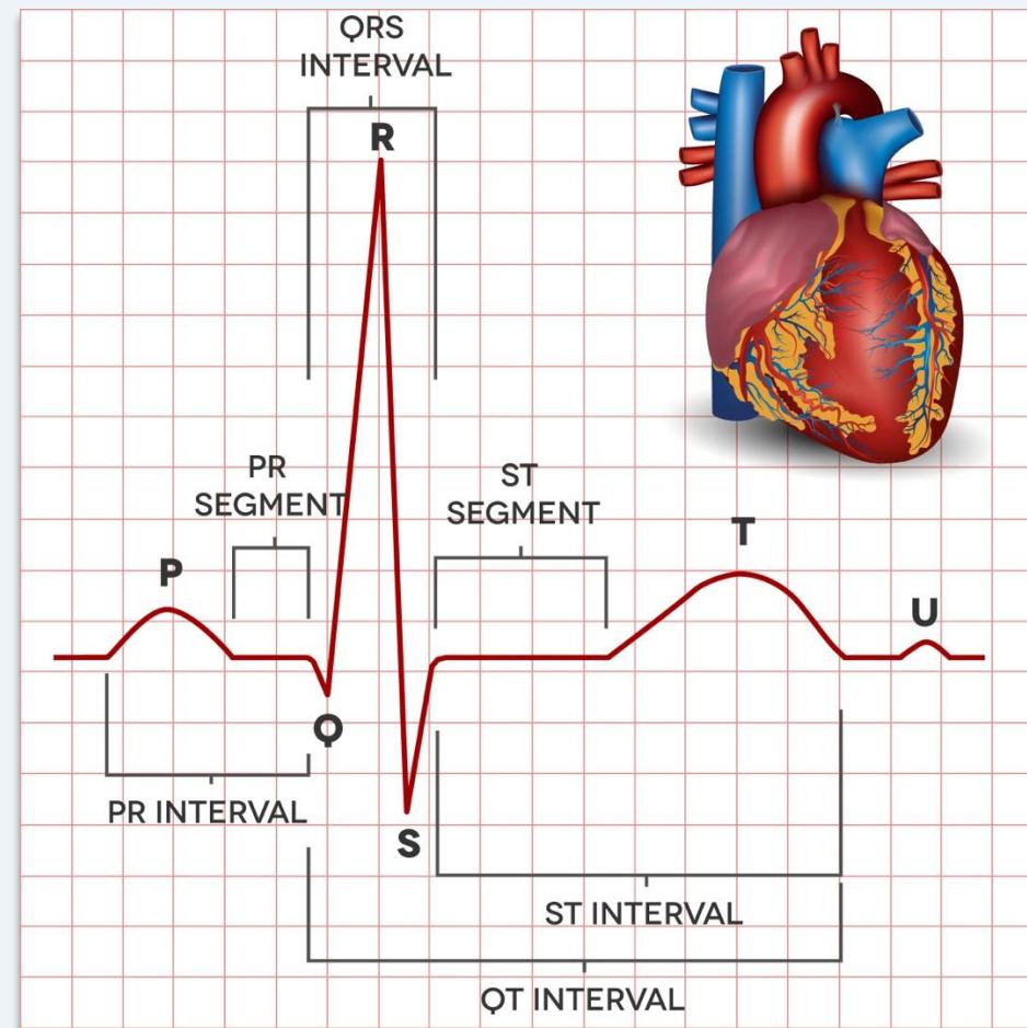 ECG findings composite