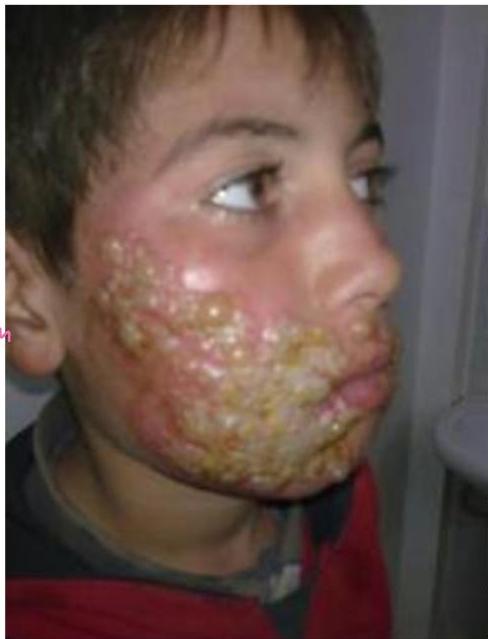 img-106.jpeg|244x319