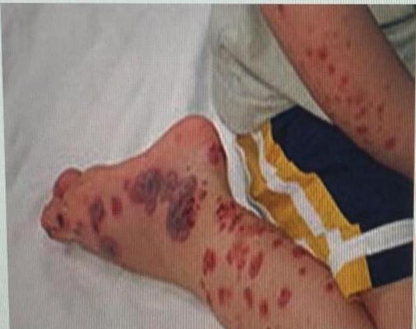 img-113.jpeg|261x237