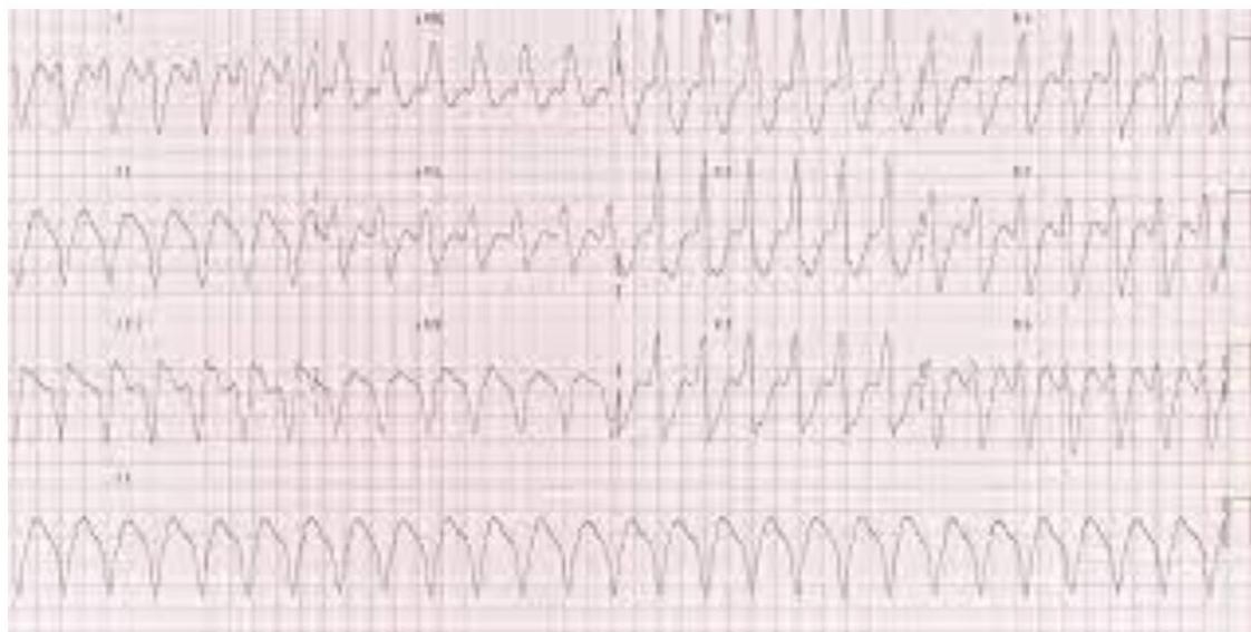 img-123.jpeg|402x203