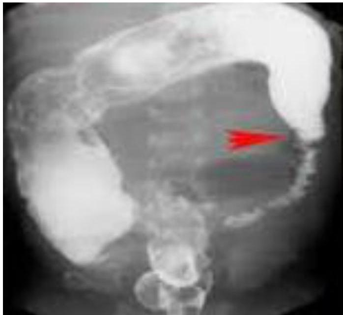 img-125.jpeg|289x265