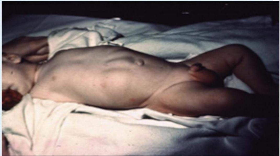 img-135.jpeg|319x178