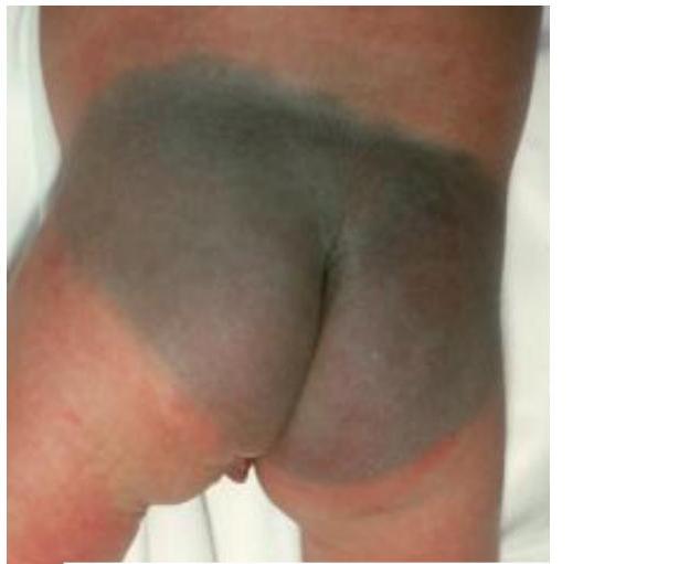 img-177.jpeg|399x322