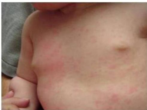 img-183.jpeg|267x201