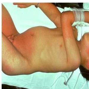 img-187.jpeg|228x230