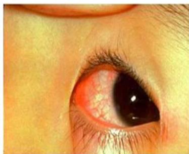 img-188.jpeg|278x226