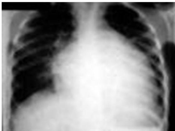 img-193.jpeg|326x244