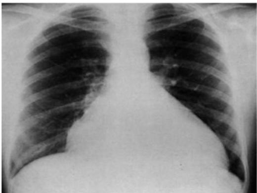 img-194.jpeg|208x156