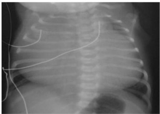 img-196.jpeg|327x233