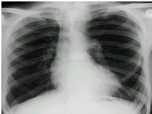 img-197.jpeg|284x214