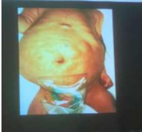 img-207.jpeg|298x276