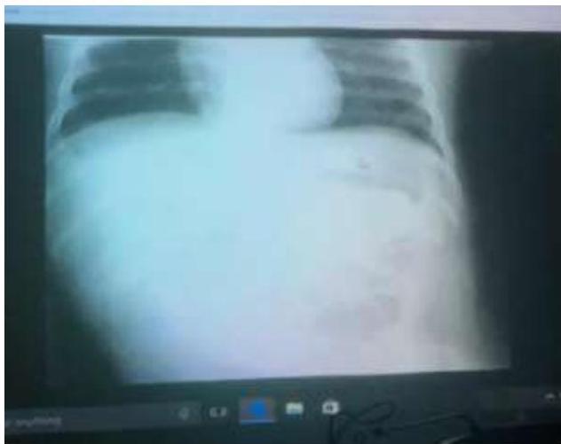 img-226.jpeg|388x308