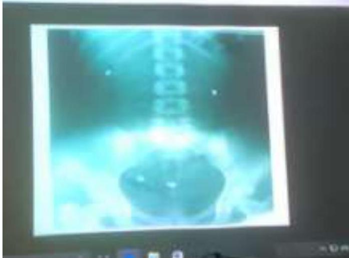 img-235.jpeg|377x279