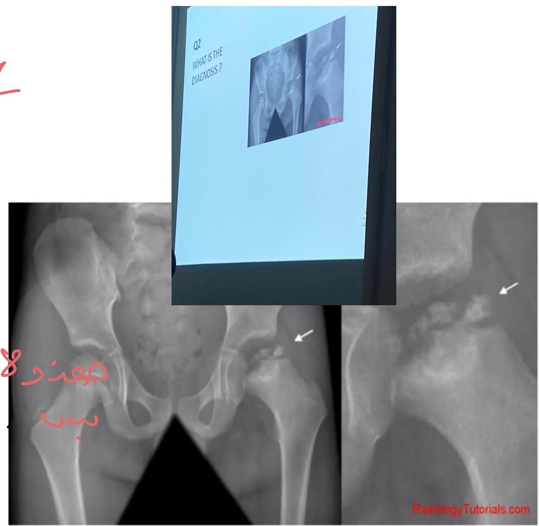 img-287.jpeg|593x579