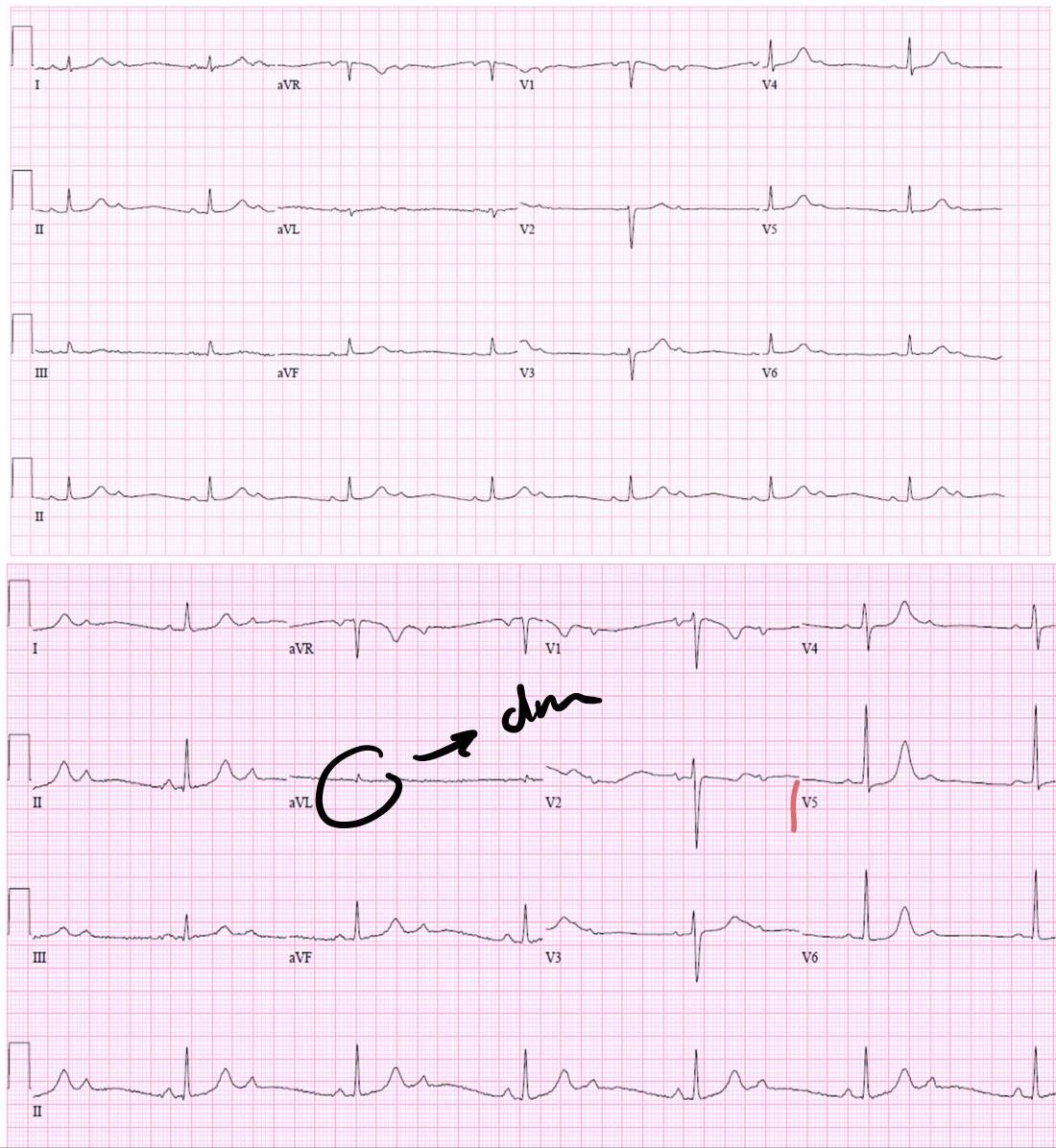 img-317.jpeg|496x539