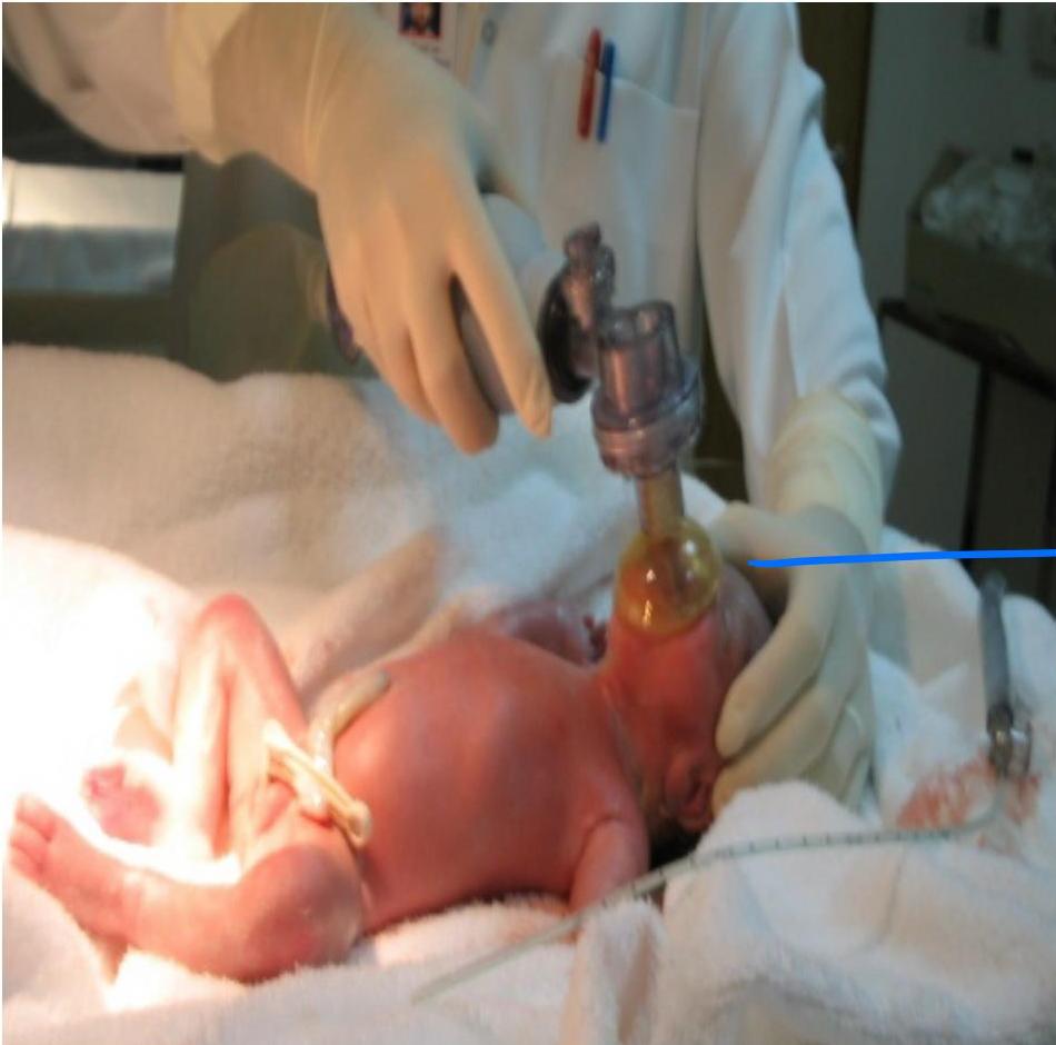 img-326.jpeg|294x291