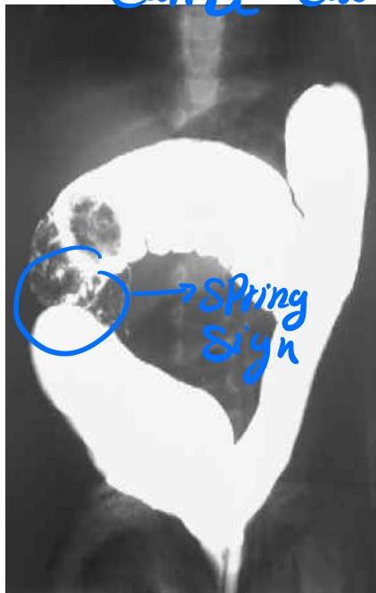 img-336.jpeg|292x460