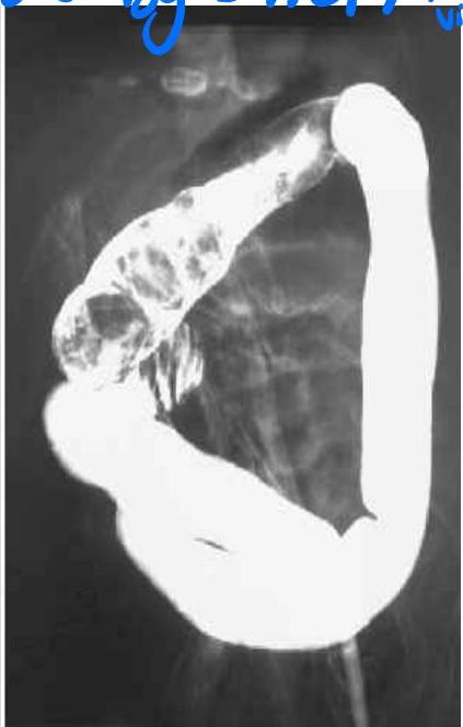 img-337.jpeg|255x454