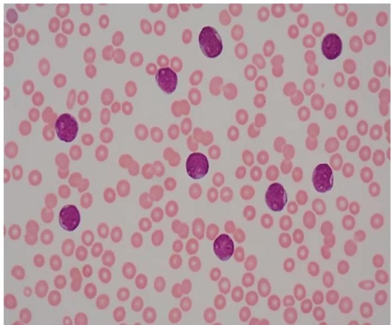 img-347.jpeg|232x212