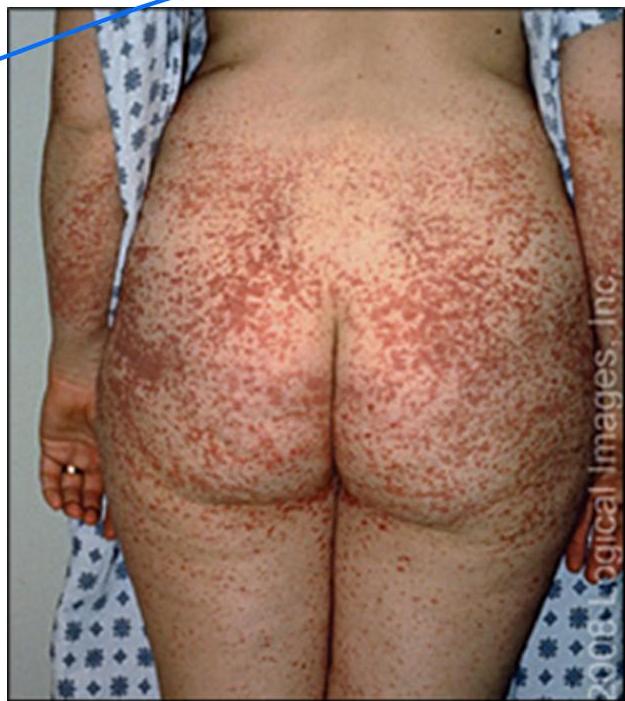 img-366.jpeg|211x237