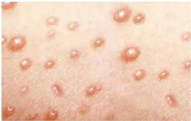 img-370.jpeg|288x184