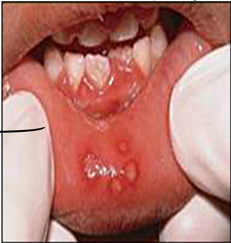 img-374.jpeg|216x227