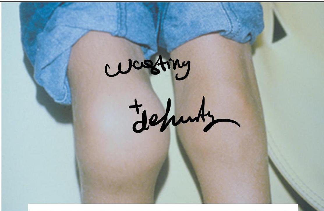 img-380.jpeg|308x201