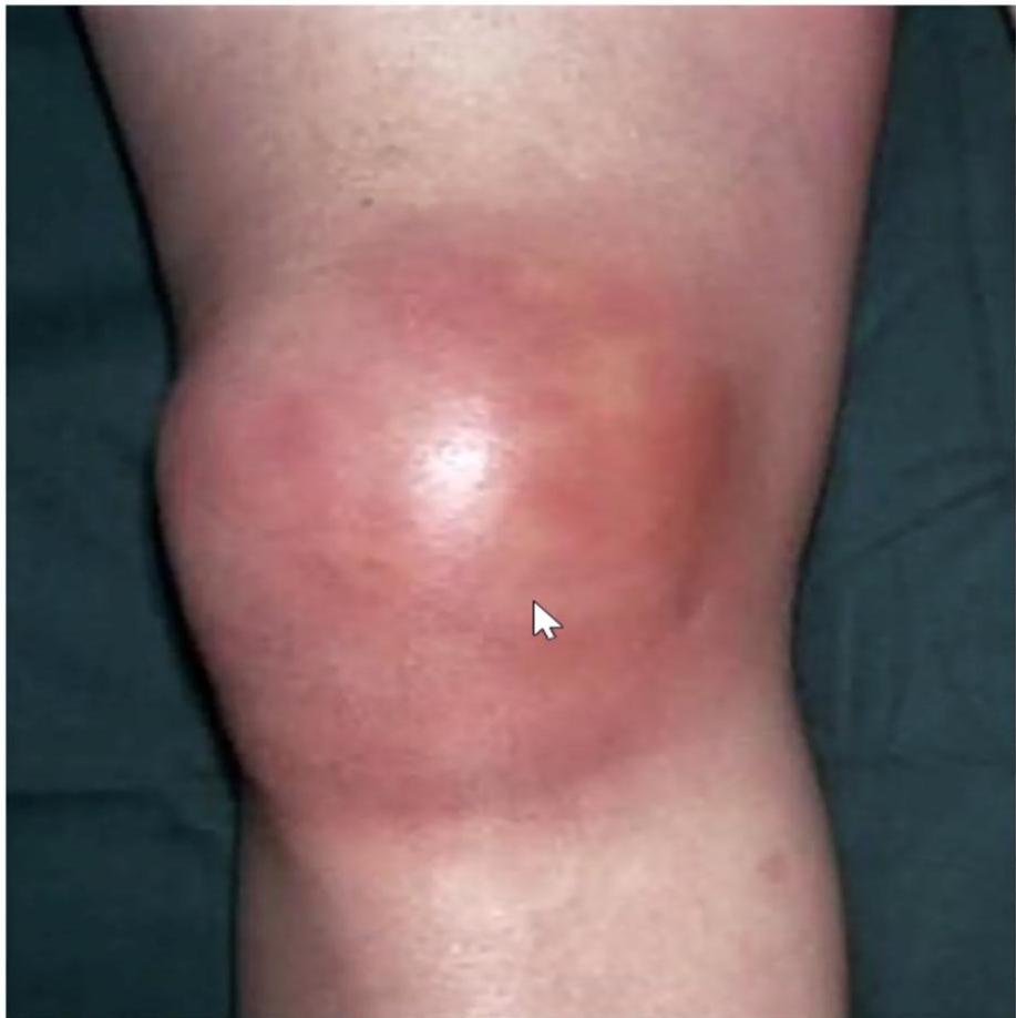 img-381.jpeg|267x267