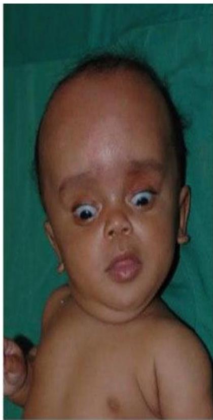 img-415.jpeg|238x322