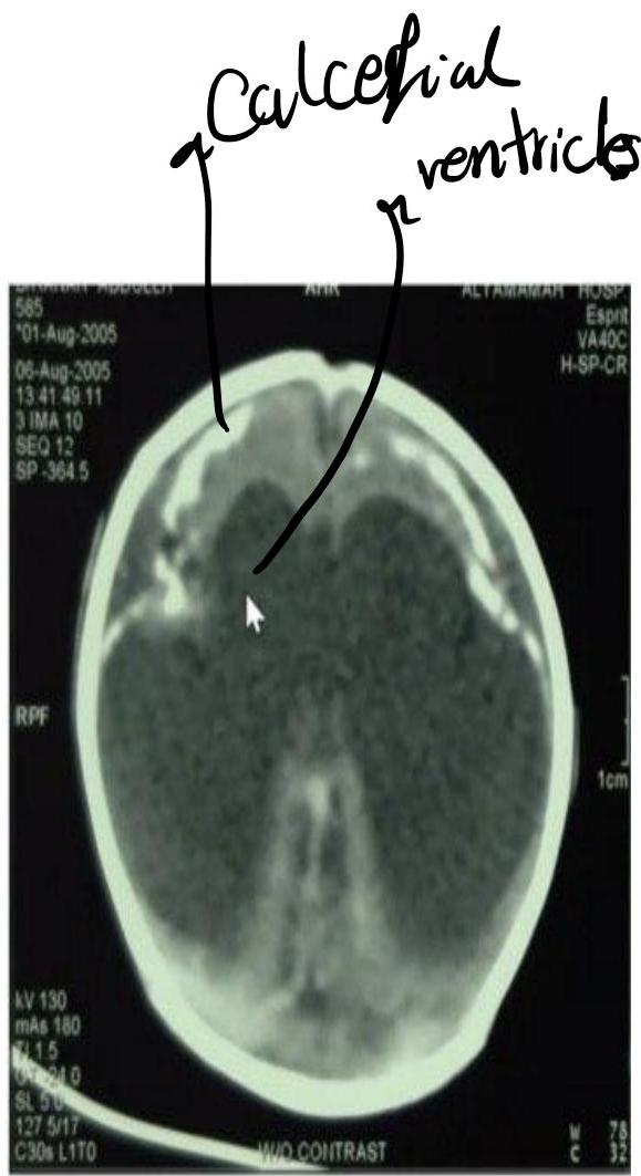 img-416.jpeg|174x319