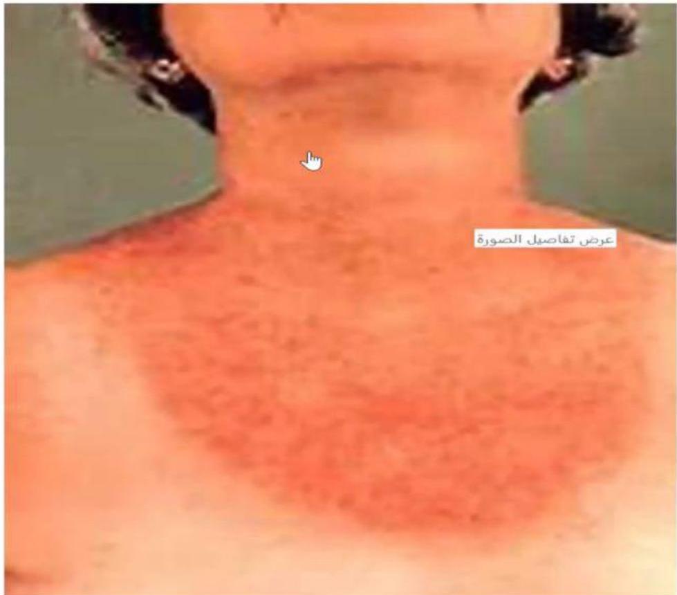 img-417.jpeg|301x264