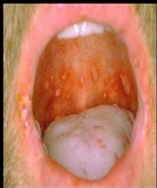 img-432.jpeg|315x317