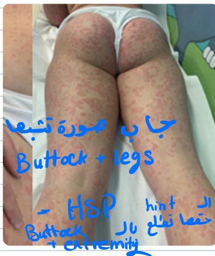 img-460.jpeg|202x241