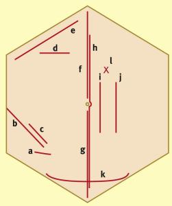 Anterior Abdominal Wall Incisions