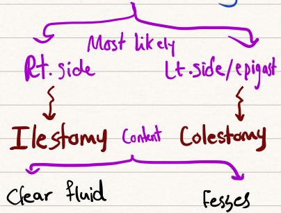 Clinical Photographs of Stoma Complications